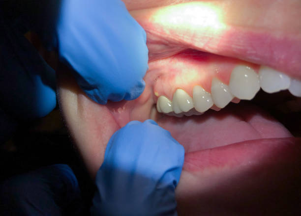 Best After-Hours Dental Trauma Care in Stapleton, AL