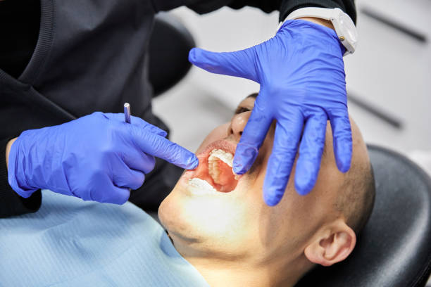Best Emergency Tooth Extraction in Stapleton, AL